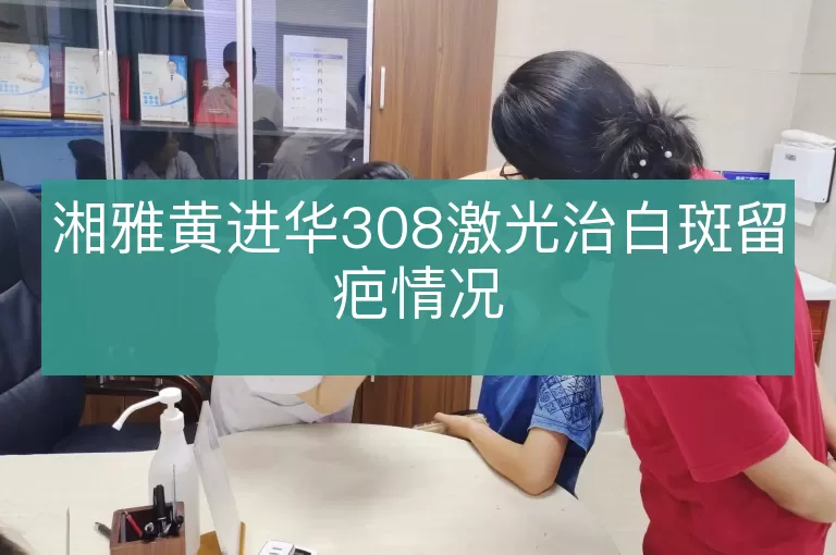 湘雅黄进华308激光治白斑留疤情况