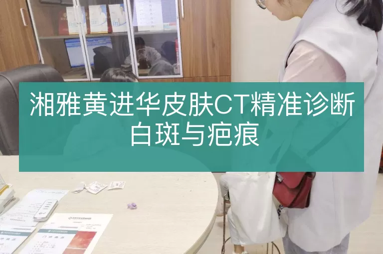 湘雅黄进华皮肤CT精准诊断白斑与疤痕
