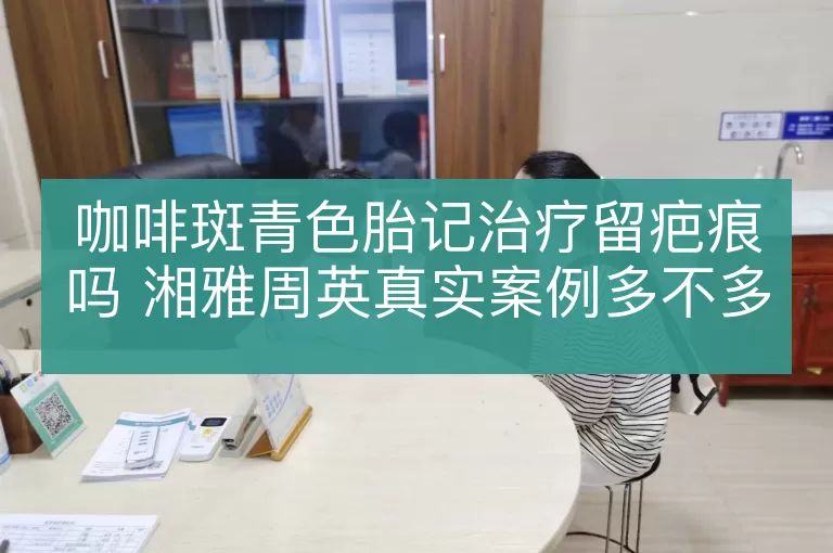 咖啡斑青色胎记治疗留疤痕吗 湘雅周英真实案例多不多