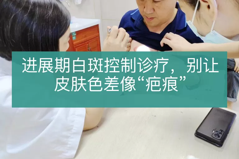 进展期白斑控制诊疗，别让皮肤色差像“疤痕”