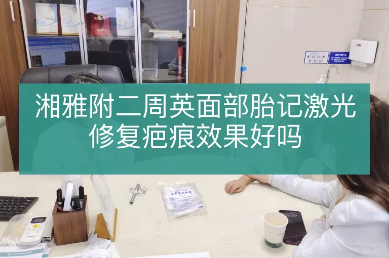 湘雅附二周英面部胎记激光修复疤痕效果好吗