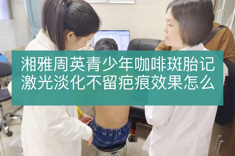 湘雅周英青少年咖啡斑胎记激光淡化不留疤痕效果怎么样